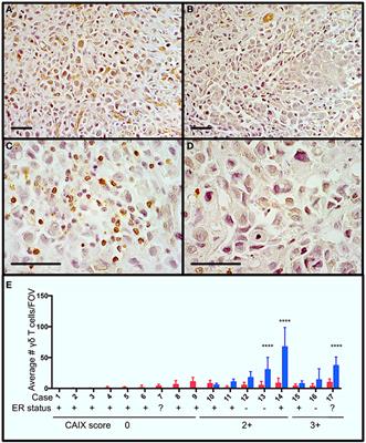 Functional Plasticity of Gamma Delta T Cells and Breast Tumor Targets in Hypoxia